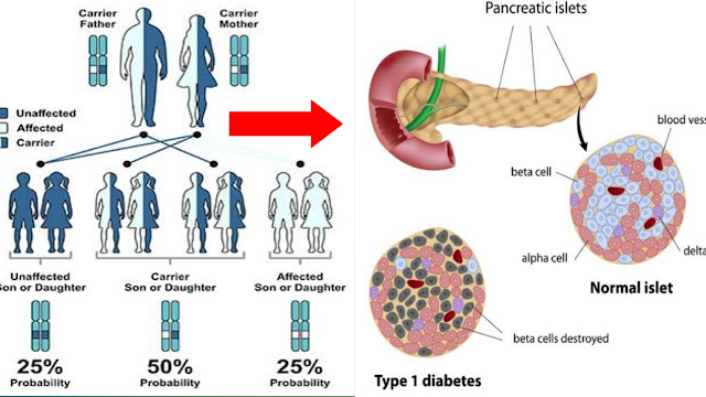 hidden-secret-behind-type-2-diabetes-is-genetic.png