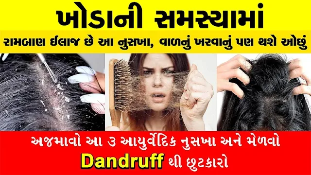 Dandruff problem solve to this remedy