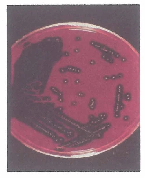 staph aureus on blood agar with complete beta hemolysis