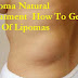 Lipoma Natural Treatment - How To Get Rid Of Lipomas