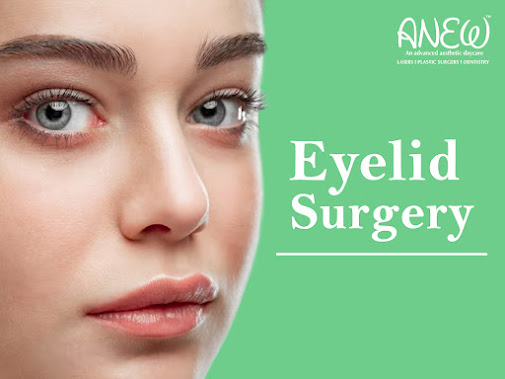 eyelid surgery in Bangalore