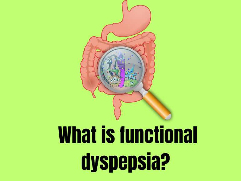 functional dyspepsia