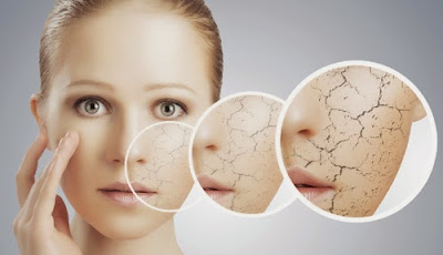 Skin care in winter Skin care tips for Dry skin 