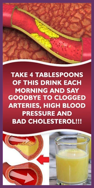 Take 4 Tablespoons Of This Drink Each Morning And Say Goodbye To Clogged Arteries, High Blood Pressure And Bad Cholesterol!!!