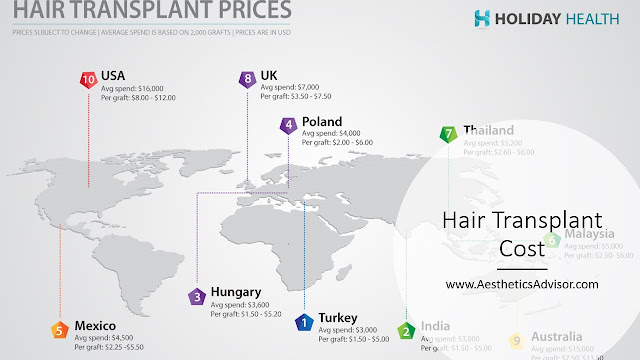hair transplant prices