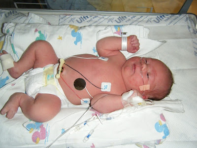 Spencer in NICU - 12 hours