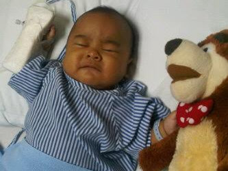Bayiku, Operasi Tutup Yeyunustomi