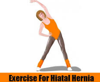 Exercise And Hiatal Hernia