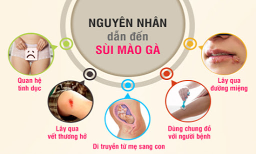 địa chỉ chữa sùi mào gà uy tín