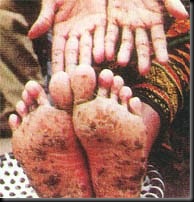 feet1