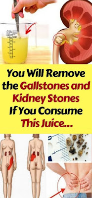 The Natural Cure for Melting Stones in the Kidneys and Gallbladder