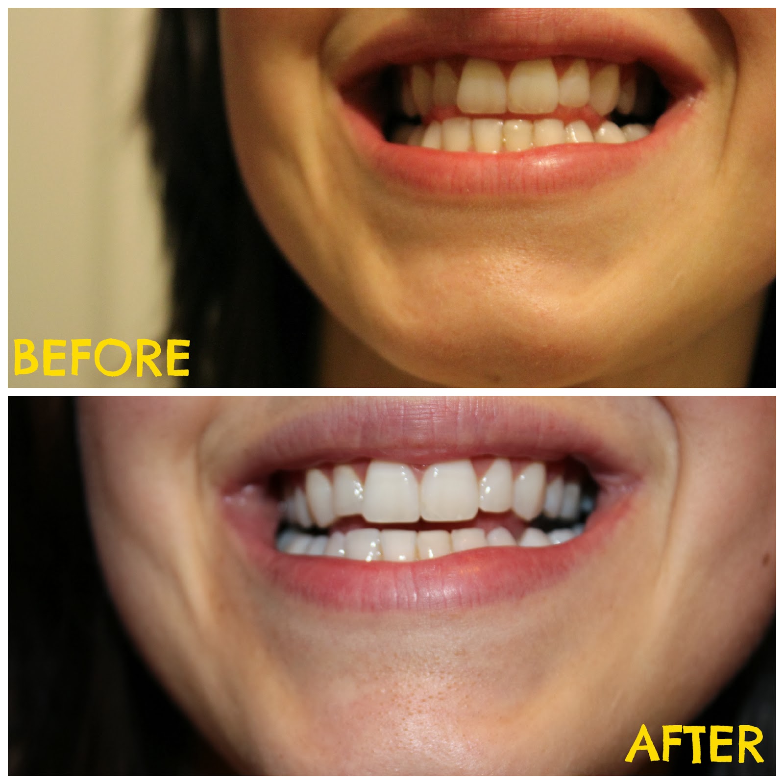 The Primitive Homemaker: DIY Tooth Whitening Paste (Before &amp; After!)