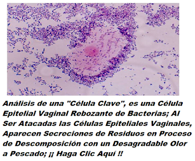 vaginosis bacteriana figura de celula clave