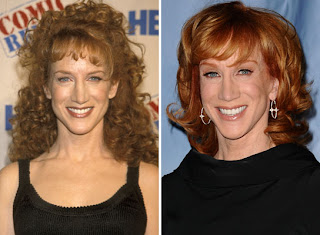 Kathy Griffin Plastic Surgery Before and After