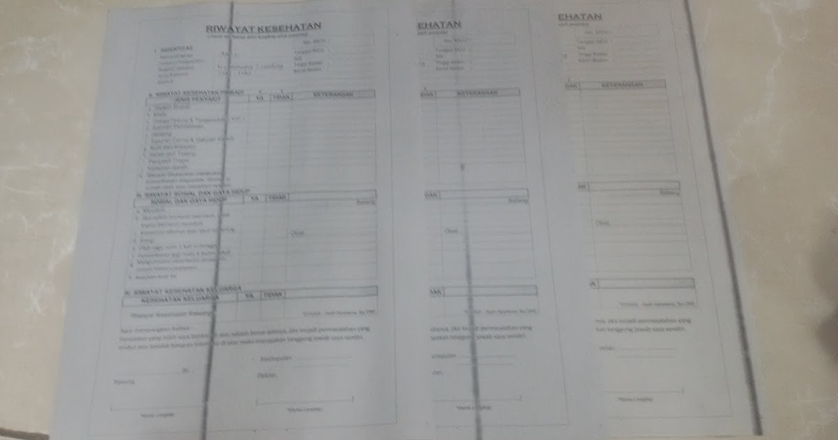 Mengatasi hasil fotocopy garis hitam Vertikal pada canon 