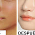 Make Magical Skin Whitener Cream At Home And Lighten Face Quickly