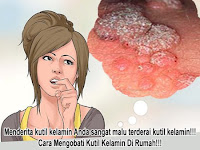 Obat Kutil Kelamin Untuk Wanita Hamil