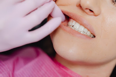 How Long Should You Leave Your Gauze in After a Tooth Extraction