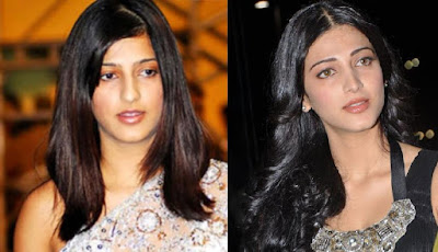 Shocking and Unbelievable Celebrities After Plastic Surgery