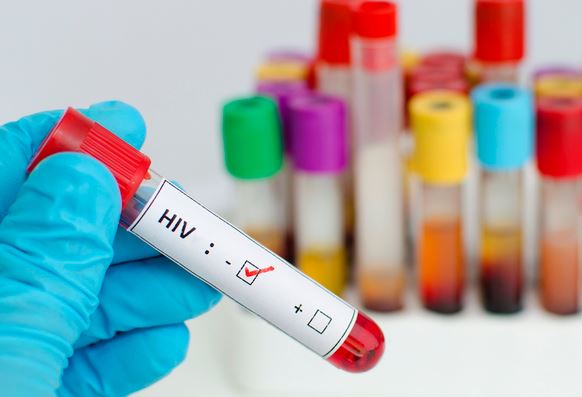 Tại sao côn trùng đốt hay súc vật cắn lại không làm lây truyền HIV?