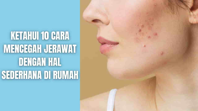 Ketahui 10 Cara Mencegah Jerawat (Jerawatan) Dengan Hal Sederhana Di Rumah Apa Itu Jerawat ? Jerawat adalah suatu kondisi pada kulit yang terjadi ketika folikel rambut tersumbat oleh minyak dan sel kulit mati. Ini menyebabkan whiteheads, bleckheads atau jerawat. Umumnya ini terjadi dikalangan remaja, meskipun tidak menutup kemungkinan mempengaruhi orang-orang dari segala usia.    Gejala Tanda-tanda yang ditemui pada jerawat bervariasi tergantung tingkat keparahannya:  Komedo putih (pori-pori tersumbat tertutup) Blackheads (membuka pori-pori yang tersumbat) Benjolan kecil berwarna merah dan lunak (papula) Jerawat (pustula), yaitu papula dengan nanah di ujungnya Benjolan besar, padat, dan nyeri di bawah kulit (nodul) Benjolan berisi nanah yang menyakitkan di bawah kulit (lesi kistik)  Jerawat biasanya muncul di wajah, dahi, dada, punggung atas, dan bahu.    Penyebab Ada empat faktor utama penyebab jerawat yakni:  Folikel rambut tersumbat oleh minyak dan sel kulit mati Peradangan Bakteri Kelebihan produk minyak (sebum)    Mencegah Jerawat Memang tidak selalu mungkin untuk sepenuhnya mencegah jerawat, akan tetapi Anda bisa mengambil langkah-langkah tertentu di rumah untuk membantu menurunkan kemungkinan terkena jerawat atau berjerawat. Langkah-langkah sederhana yang bisa dilakukan di rumah ialah:  Mencuci wajah setiap hari dengan pembersih bebas minyak Mencoba pembersih jerawat OTC untuk membantu menghilangkan minyak berlebih Gunakan riasan berbahan dasar air atau produk berlabel nonkomedogenik-ini berarti produk tersebut cenderung menyumbat pori-pori pada kulit wajah Menghindari produk perawatan kulit dan riasan yang mengandung minyak Selalu hapus riasan dan bersihkan kulit secara menyeluruh sebelum tidur Mandi atau cuci muka setelah berolahraga Ikat rambut panjang ke belakang agar tidak menutupi wajah Menghindari topi, ikat kepala, dan pakaian ketat yang menutupi area rawan berjerawat Makan diet seimbang, dan tetap terhidrasi (rutin minum air putih) Selalu ambil langkah-langkah untuk mengurangi stress, karena rasa stres yang berlebihan dapat menimbulkan jerawat