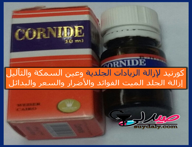 كورنيد محلول Cornide Topical Solution لإزالة الجلد الميت من القدم