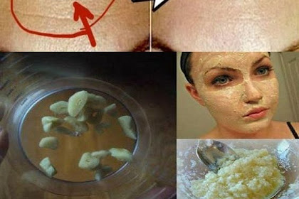 This Amazing Garlic Recipe Will Remove Your Wrinkles In 7 Days