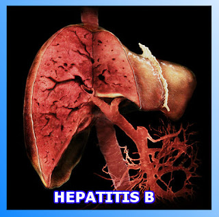 penyakit hepatitis b