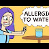 I Am Allergic To Water - true story 