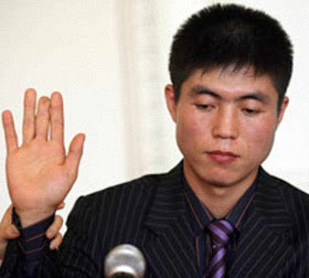 Shin Dong-hyuk teve o dedo cortado pelos carcereiros como punição