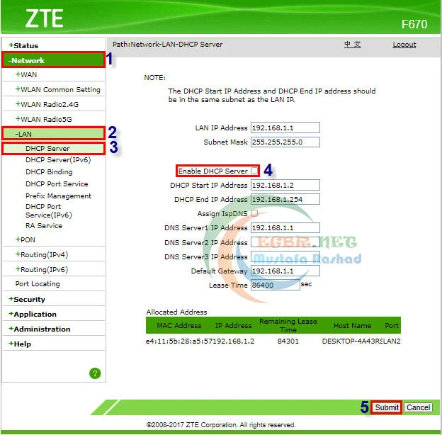 غلق dhcp في راوتر zxhn f670