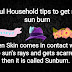 Useful Household tips to get rid of sun burn