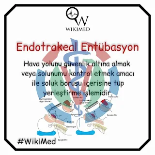 endotrakeal-entübasyon