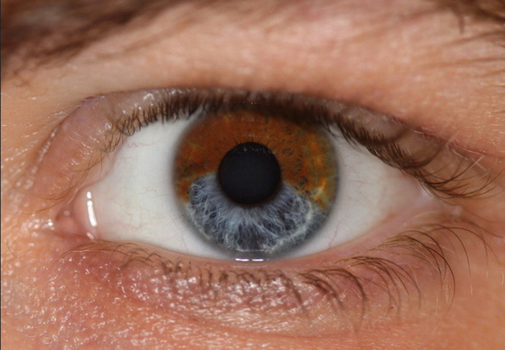 Do You Know That Your Eyes Color May Change? Herein The Details.