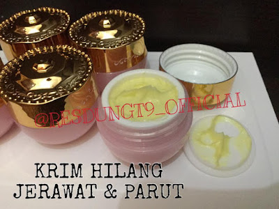 Beauty Design: RAHSIA HILANG JERAWAT & PARUT DENGAN 