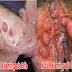 Obat herbal kutil kelamin untuk pria thumbnail