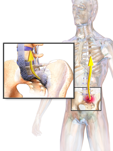 Ankylosing Spondylitis Pathogenesis