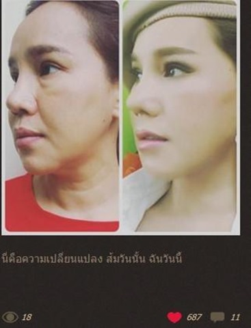 qq_photo20160206120224_1454735642