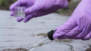 Rio Grande do Sul confirma primeira morte por leptospirose; veja sintomas