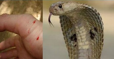 These are the things you should and should not do after being bitten by a snake
