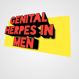 Genital herpes in men