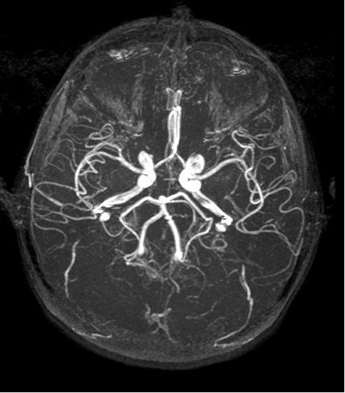 Brain Radiology3