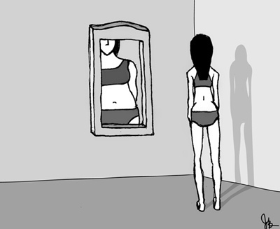 Patients with Anorexia, trend or disorder?