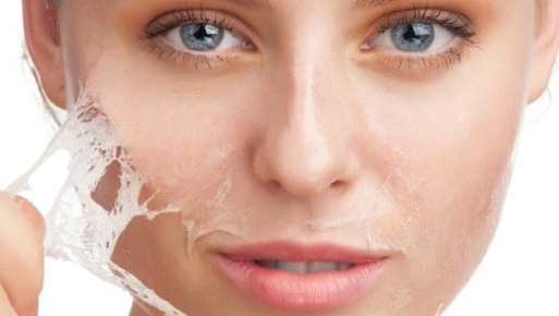 Treatment For Acne Scars On Cheeks