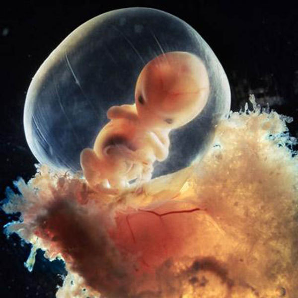  Gambar Pembentukan Bayi Dari Sperma dan Ovum