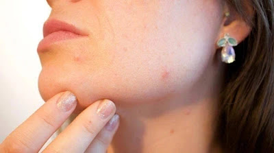 How to Use Alum (Phitkari) for Skin Whitening