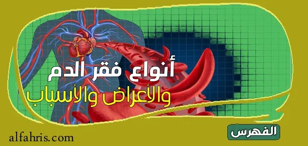 أنواع فقر الدم وأعراضه وأسبابه