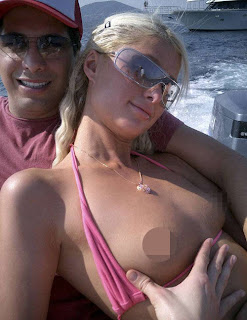 paris-hilton-breast-beauty