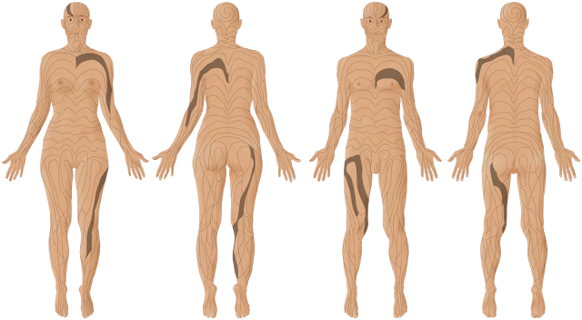 diagrama de líneas de Blaschko en cuerpos masculinos y femeninos