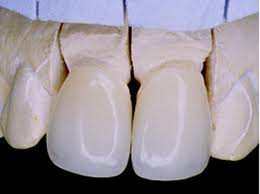 Cómo limpiar las prótesis dentales (Odontología)